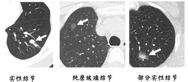 很多人说