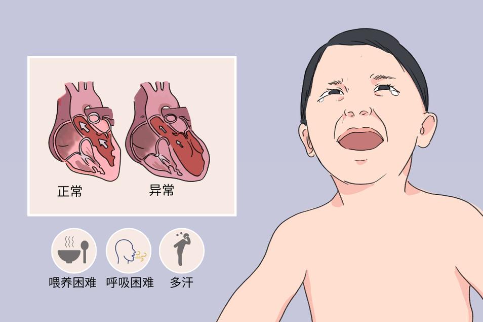 新生儿扩张型心肌病