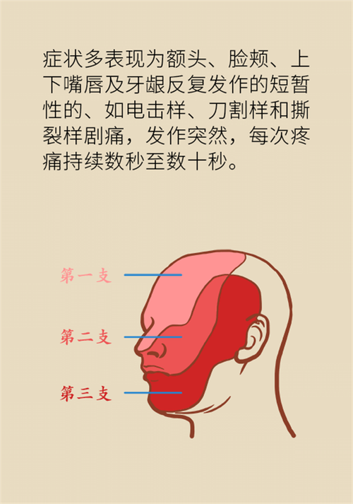 这种疼痛不是牙疼?缓解三叉神经痛就用这两招