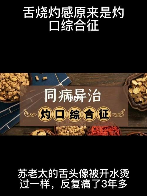 舌头烧灼感原来是灼口症