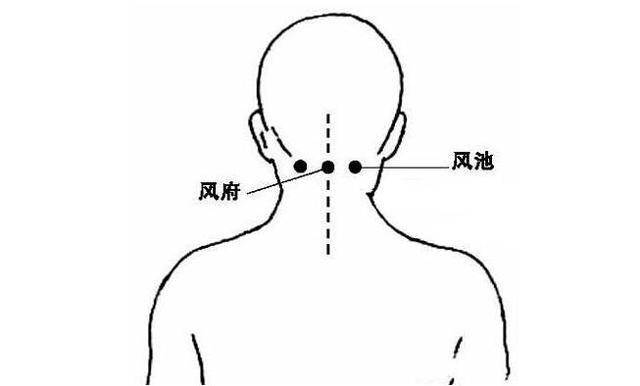 中医针灸治疗头晕的经验特效穴——风池穴