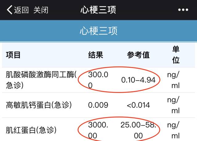 而网友测出来高达3000 超过指标上限51倍 肌酸磷酸激酶同工酶的最高参