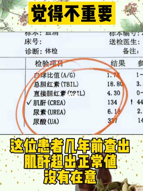 肌酐超出正常值一定要重视别发展到尿毒症