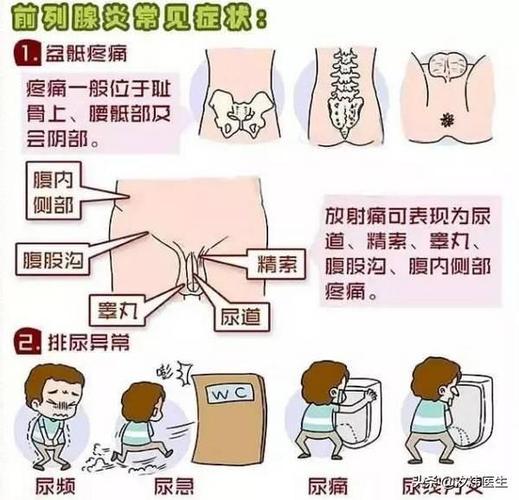 头条问答 - 怎么判断是不是得了前列腺炎?(24个回答)