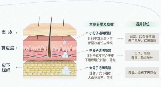 玻尿酸,到底是什么?