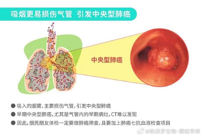 肺癌七抗##肺结节血液检查##肺结节抽血查七抗##肺结节##肺癌