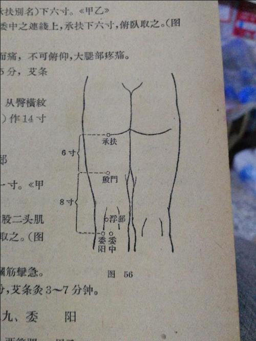 委阳穴针刺后小腿无力是什么原因