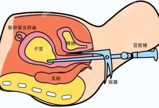 女性私密部位结构图