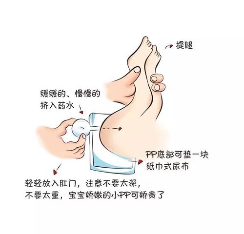 开塞露怎么使用