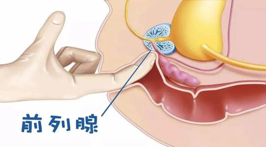 【前列无忧】前列腺 尿道球腺(深度)按摩治疗_前列腺炎_前列腺炎治疗