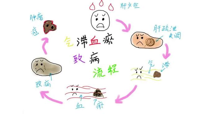 血瘀百病生,四种活血化瘀宝贝,针对不同血瘀体质