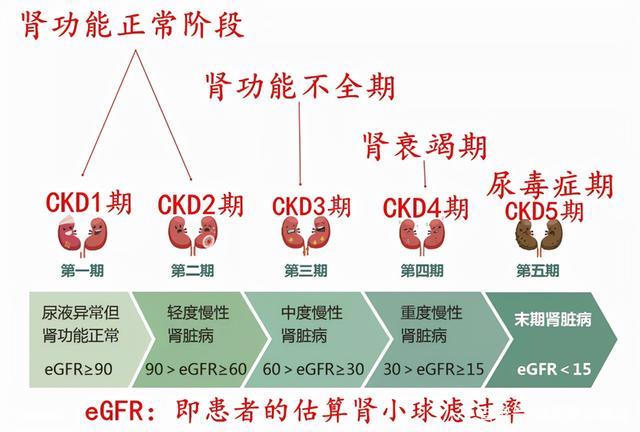 肌酐高是肾衰竭的早期警告,2个方法自然降肌酐,远离尿毒症