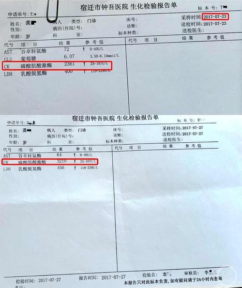 住院期间两次肌酸激酶检测数据均超过参考最高值10倍.