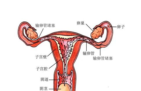 女性输卵管堵塞有哪些预防方法_疾病_进行_阴道