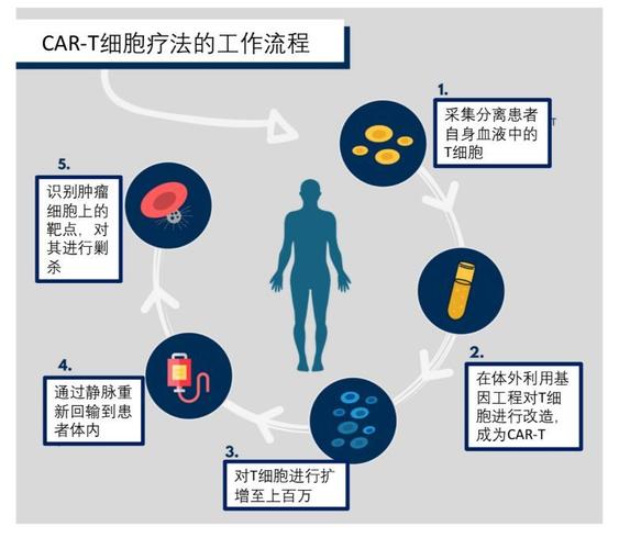 83的患者肿瘤细胞完全消除cart疗法迎来白血病治疗新篇章