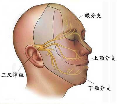 三叉神经疼可以治疗好吗