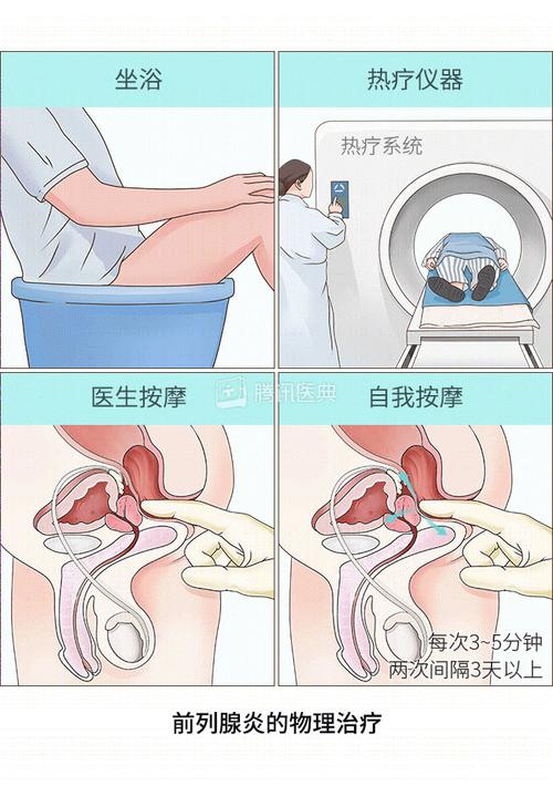 怎么做前列腺按摩根据是否有他人协助分为以下两种:·医生按摩.