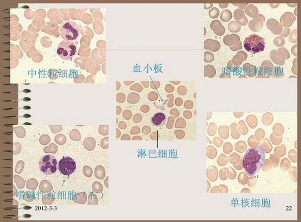 正常值:中性粒细胞:杆状核1%～5%(0.04～0.