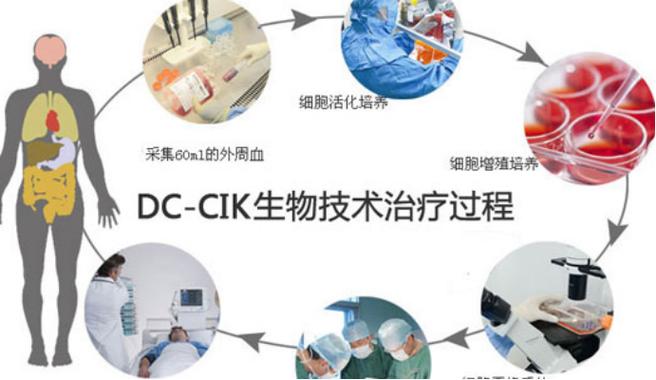 免疫治疗技术til细胞疗法能否秒杀car-t细胞疗法?