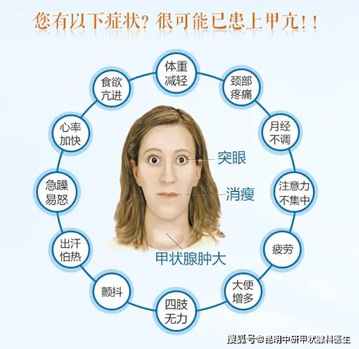 怎么判断自己的甲亢严不严重?_甲状腺_检查_代谢