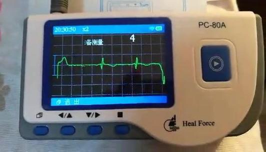 心电图机器多少钱(那个价格便宜) - 价格百科