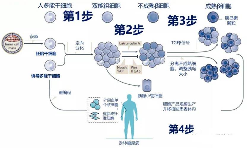 干细胞疗法,已经成为糖尿病的潜在治愈性手段_胰岛素_研究_治疗