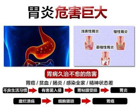 由《中国慢性胃炎共识意见(2023年版)》显示,全国有超 7亿人患有